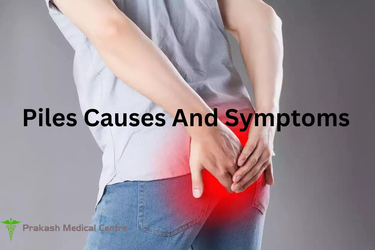 Piles Causes And Symptoms