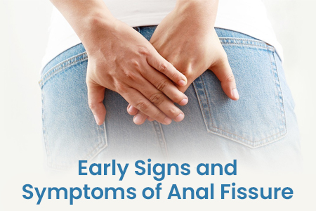 Early Signs and Symptoms of Anal Fissure