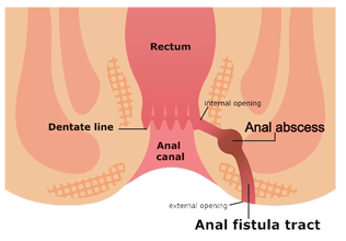 piles clinic in ghaziabad